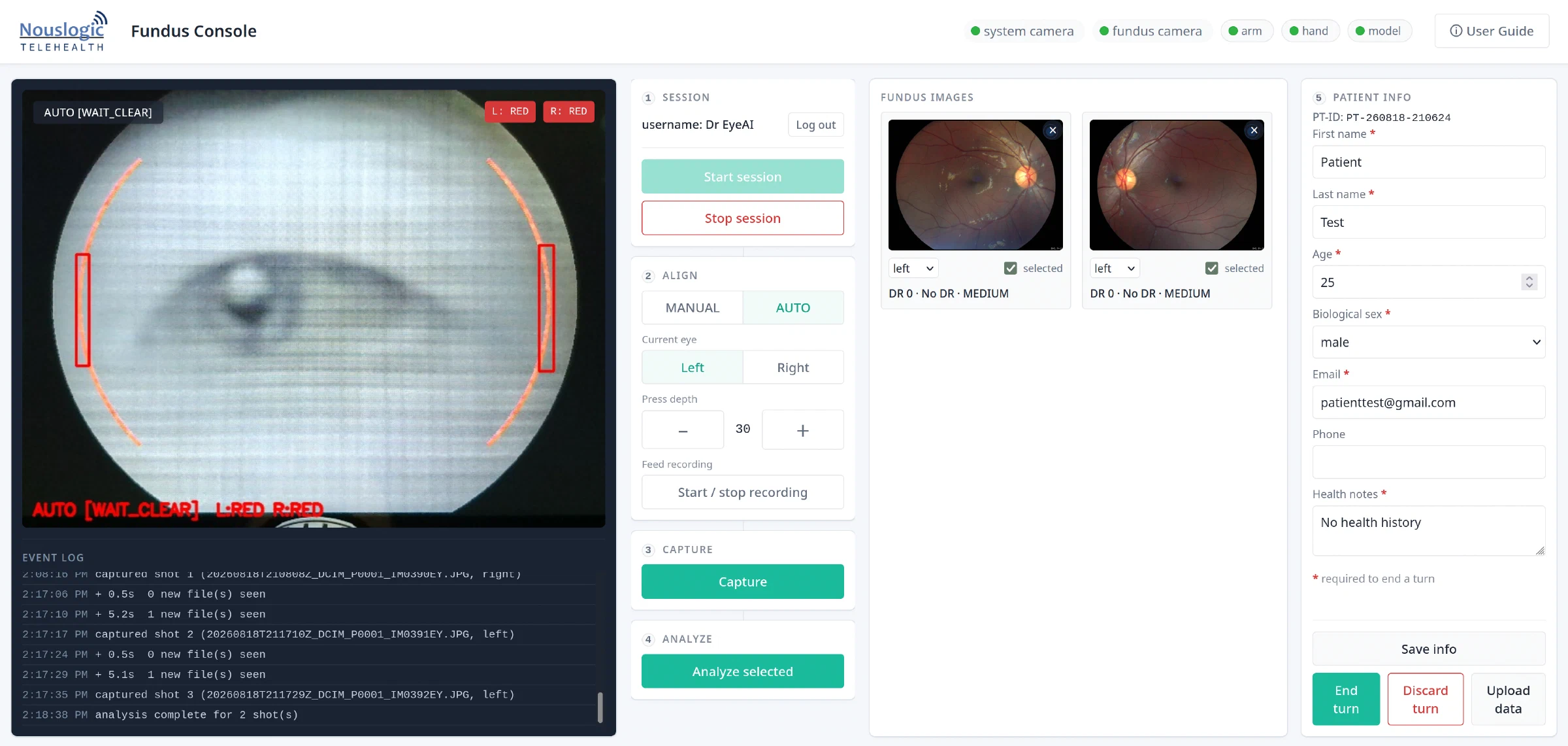 The NousLogic fundus console at full screen. A live camera view of an eye fills the left, its alignment boxes marked in red, with an event log of the capture session beneath it. A numbered column of controls runs through session, alignment, capture and analysis. Two retinal photographs sit in the middle, each graded DR 0, no diabetic retinopathy. A patient information form fills the right edge, holding test data.